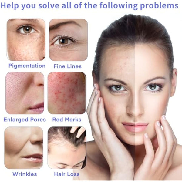 20 Pieces 12 pin Needle Cartridge for Dr.pen A6, Mysweety Microneedles for Electric Derma Microneedle Stamp Pen