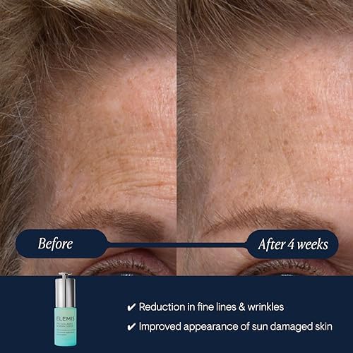 Elemis Pro-Collagen Serums – Renewal, Super Elixir & Rose Micro Serum for Smoother, Firmer, Radiant Skin (15ml & 30ml Anti-Aging Skincare)