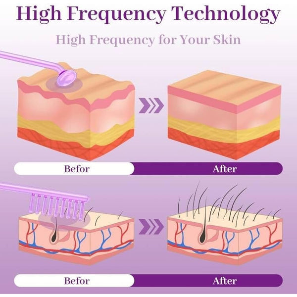 High Frequency Wand - TUMAKOU Portable Argon Light Therapy High Frequency Facial Skin Tightening Wand Machine for Acne,Wrinkle,Anti Aging,Hair - with 4 Violet Glass Tubes