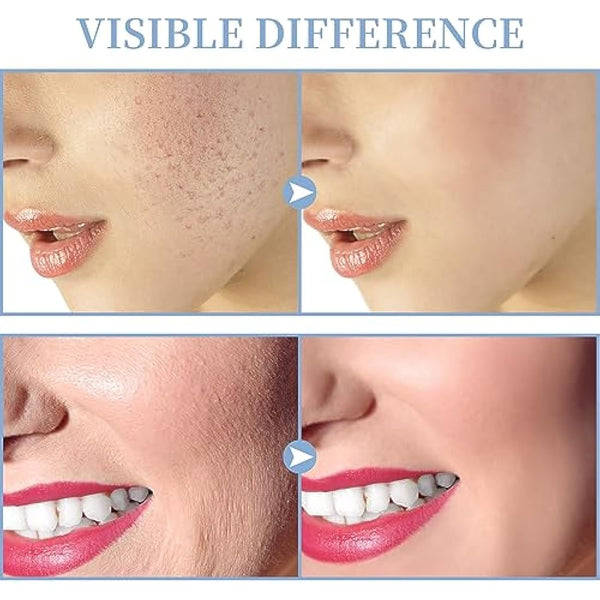 High Frequency Facial Machine, TUMAKOU Professional Portable Handheld Neon HF Face Wand, Light Therapy Facial Skin Tightening Machine Device with 4 Different Tubes