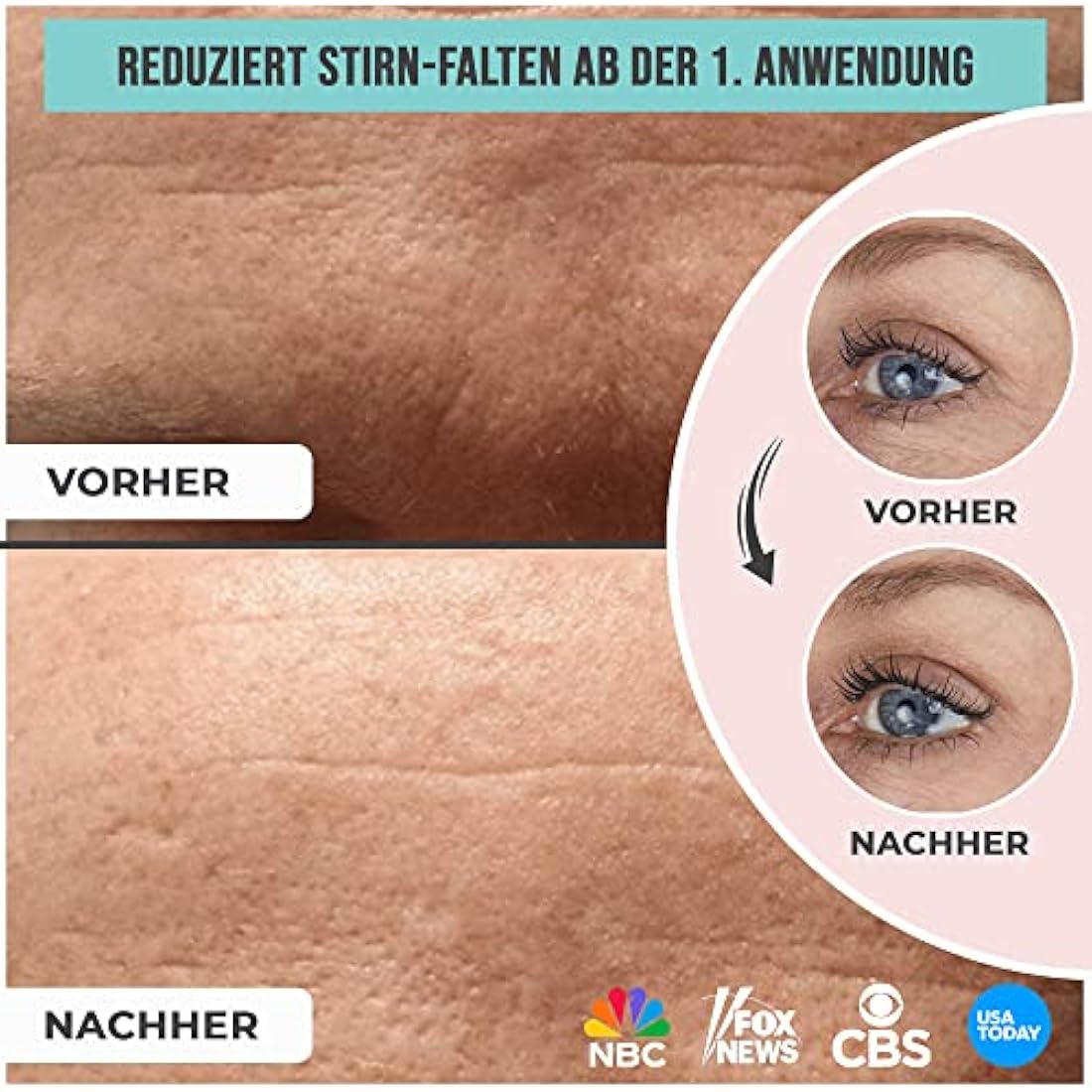 2-in-1 Sandy Skin® | 2x Forehead Pad & 1x Eye Pads | Forehead Pad | Eye Pads Wrinkle Reduction | Wrinkle Wrinkle | Forehead Wrinkle Pads | Forehead Wrinkle Reduction | Forehead Pads Against Wrinkles