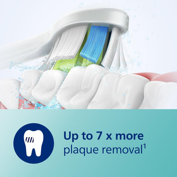 Philips Sonicare Series 7900: Advanced Whitening Sonic Electric Toothbrush with app in White, (Model HX9636/19)