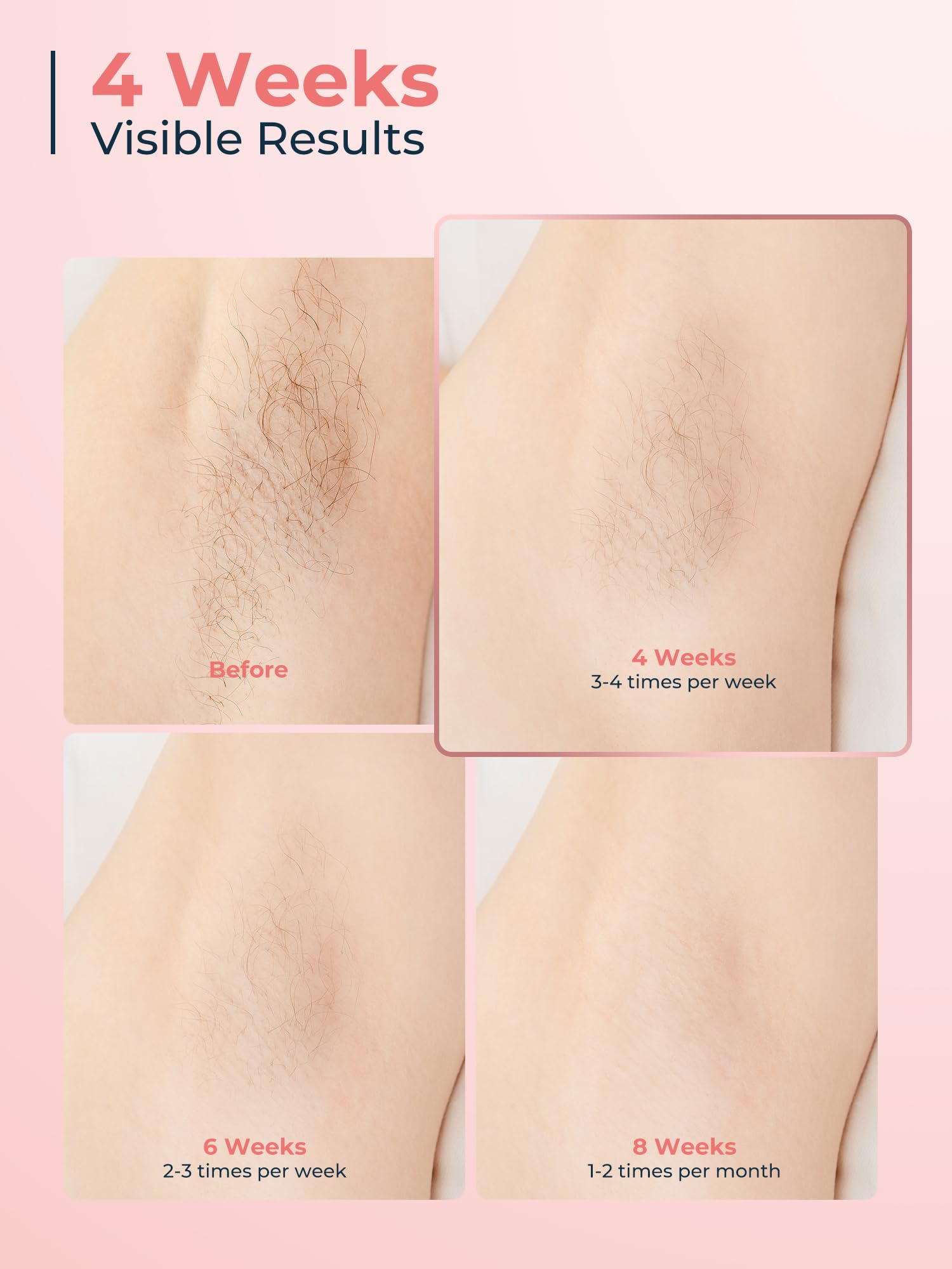 IPL Laser Hair Removal Device for Women Men, Painless Ice-Cooling Hair Remover Machine, 3 Functions, 9 Levels, at-Home Salon & Long Lasting Results for Face Bikini Line Armpits Leg Body, Rose