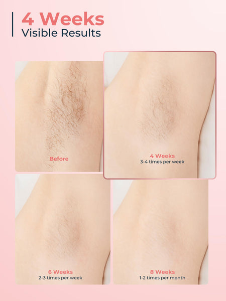 IPL Laser Hair Removal Device for Women Men, Painless Ice-Cooling Hair Remover Machine, 3 Functions, 9 Levels, at-Home Salon & Long Lasting Results for Face Bikini Line Armpits Leg Body, Rose