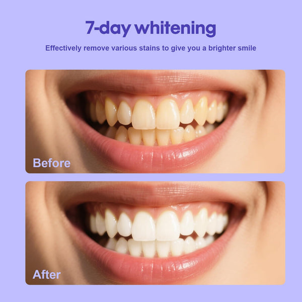 SarCop Teeth Whitening Powder - Enamel-Safe & Sensitivity-Free Natural Tooth Whitener for Coffee, Wine, Smoking Tea – Brighten Your Day, 1.7 oz