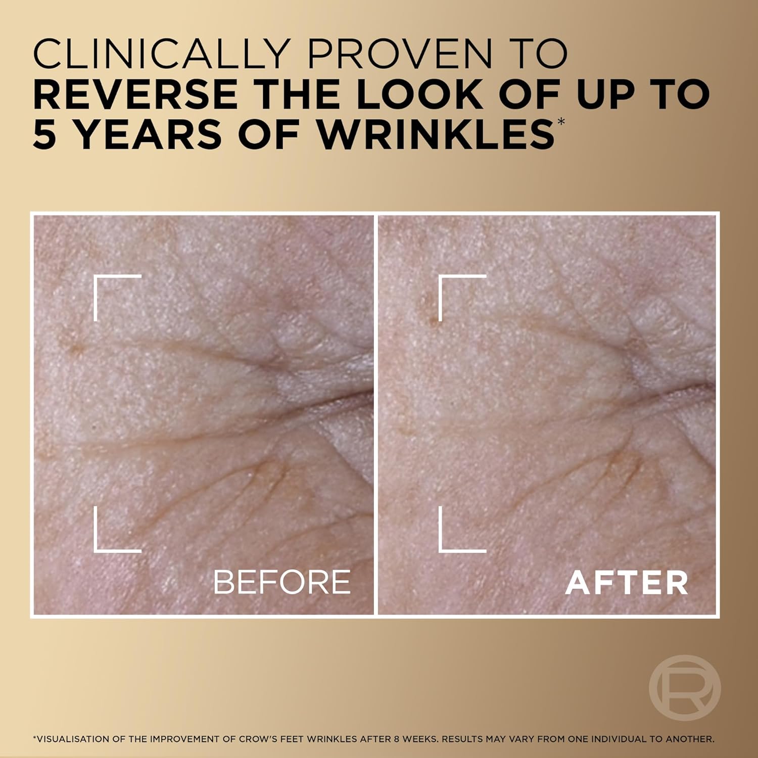 L’Oréal Paris Age Defying Serum Le Duo, Collagen Peptide Booster and Vitamins B3 & C*, Instant Firmness & Radiance, Clinically Proven Result, Reverse Appearance of up to 5 Years of Wrinkles*, 30ml