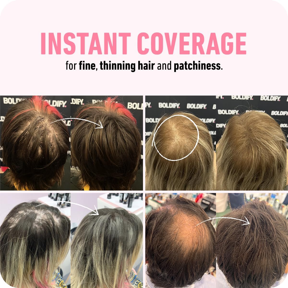 BOLDIFY Hair Fibres (56g) - Fill In Thinning and Fine Hair for an Instantly Fuller, Thicker Look - 14 Shades for Women and Men - Medium Brown