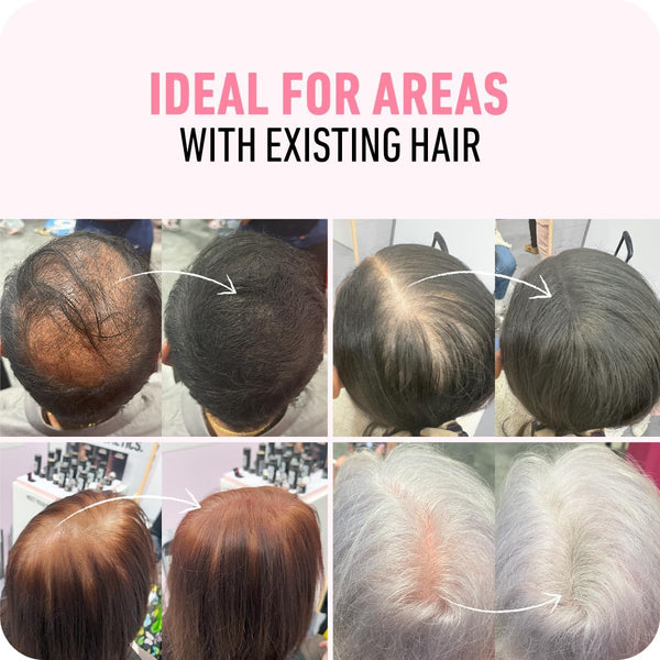 BOLDIFY Hair Fibres (56g) - Fill In Thinning and Fine Hair for an Instantly Fuller, Thicker Look - 14 Shades for Women and Men - Medium Brown