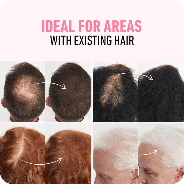 BOLDIFY Hair Fibres (56g) - Fill In Thinning and Fine Hair for an Instantly Fuller, Thicker Look - 14 Shades for Women and Men - Medium Brown