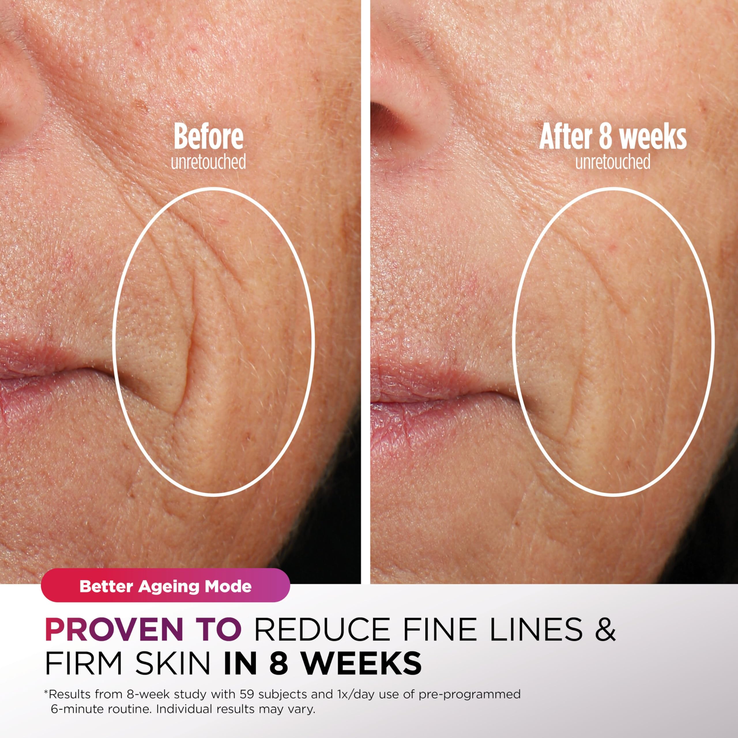 Shark CryoGlow LED Face Mask with Under-Eye Cooling, Anti-Ageing & Blemish Repair, Red & Blue LED, Infrared Light Therapy, USB-C, Remote Control, Storage Bag, Adjustable Straps